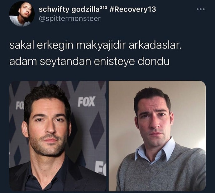 Baby face erkek mi, sakallı erkek mi daha çekicidir?