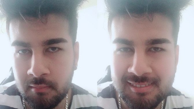 Burun estetiğine ihtiyacım var mı?