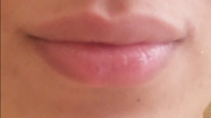 Sizce bu kizin dudakları çekici mi duruyor?