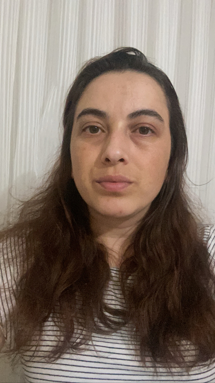 Yüzümdeki kusurlar nasıl gider sizce?