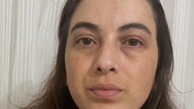 Yüzümdeki kusurlar nasıl gider sizce?