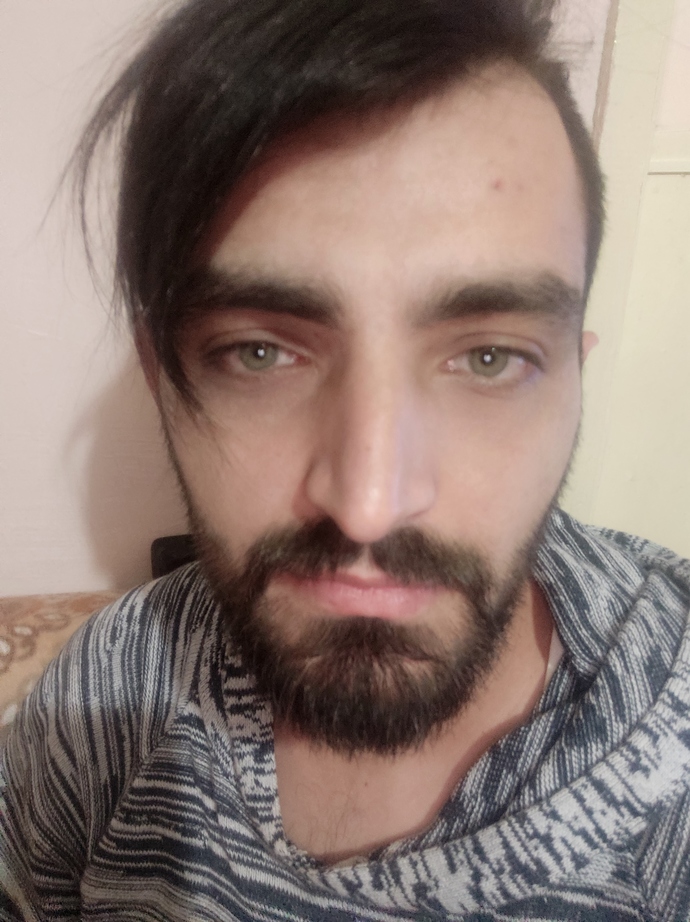 Göz altı morlukları için ne yapmalıyım?