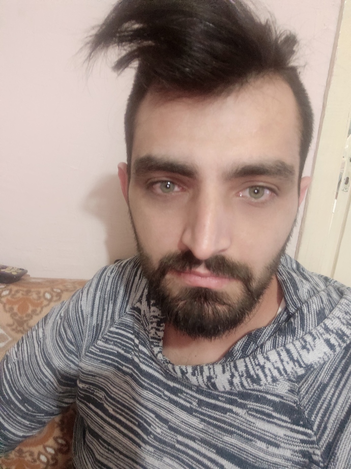 Göz altı morlukları için ne yapmalıyım?
