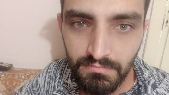 Göz altı morlukları için ne yapmalıyım?