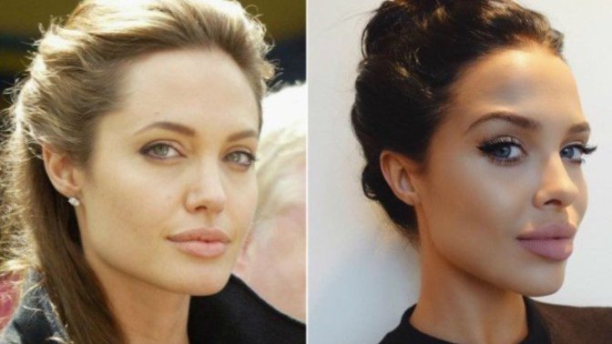 Jawline dolgusu yaptıran herkes level mı atlar?