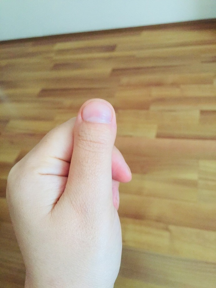 Tırnaklarım yüzünden utanıyorum. Ne yapmalıyım?
