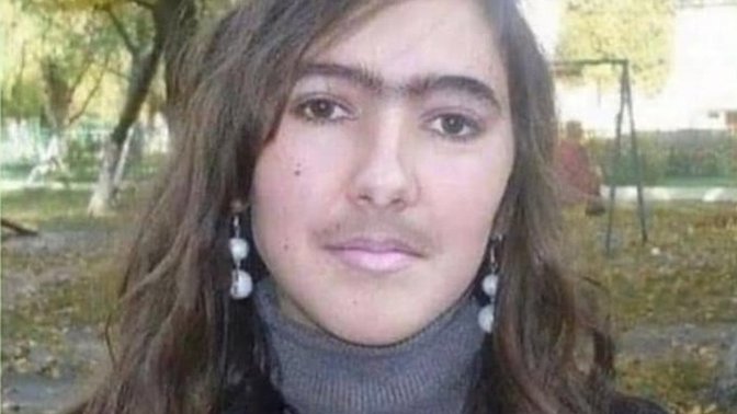 Yüz tüylerim çok hızlı uzuyor?