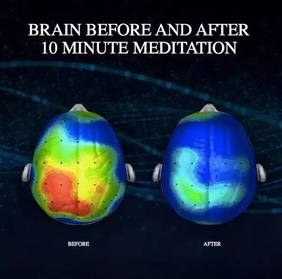 Meditasyon hiçbir işe yaramıyor ya da ben yapamıyorum dostlar yardım?