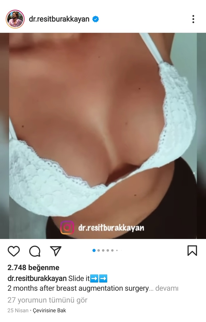 Bu tarz silikon memeler hoş mu sizce?