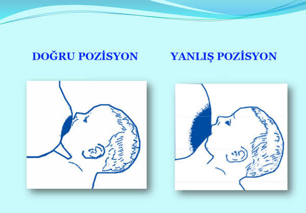 Göğüs ucum çok çok minik. Çocuk emzirirken rahat olmuyor mu?