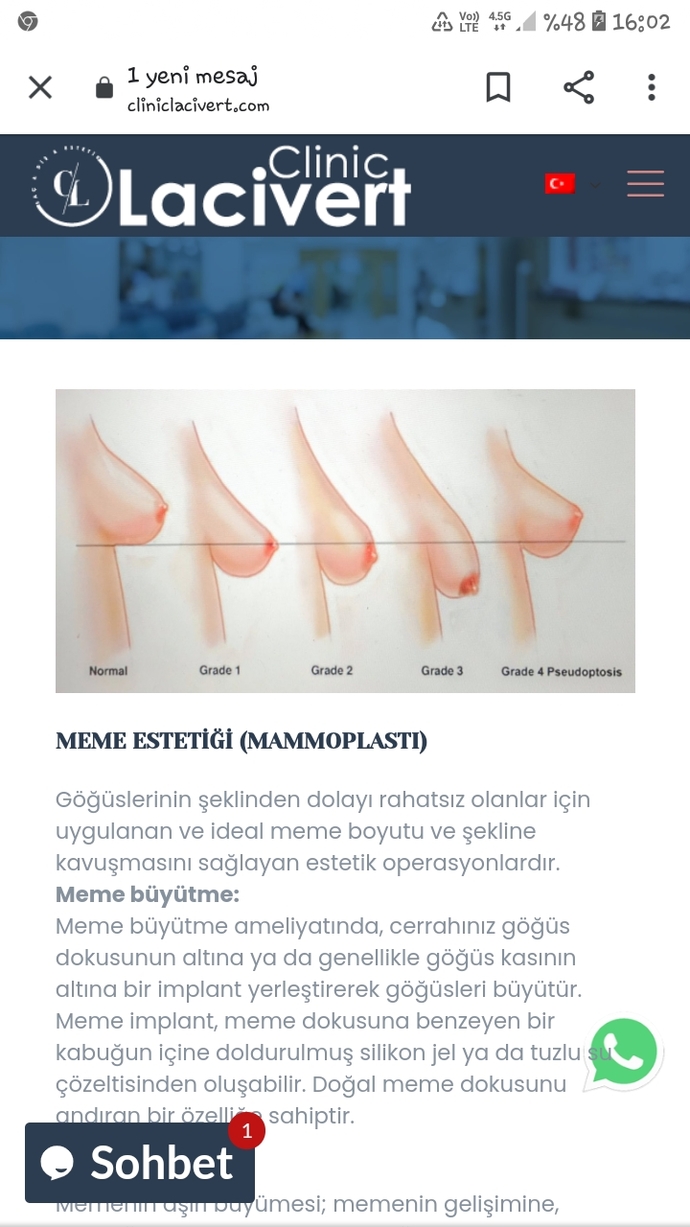 Göğüslerim sarkık mı böyle olunca?
