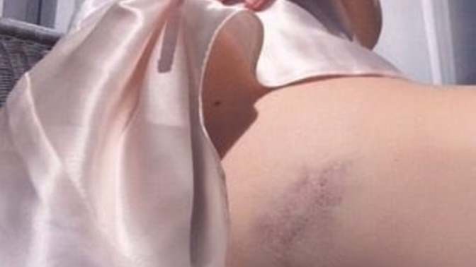 Cinsel ilişki sonrası morarma olması güzel bir şey mi?