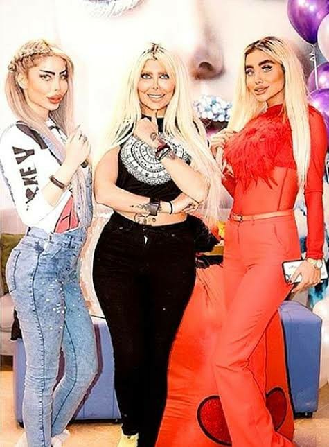 İranda estetik neden çok abartılıyor?