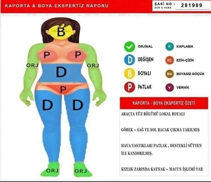 Erkekler neden estetikli kadın sevmiyorum deyip estetikli kadın seviyor?