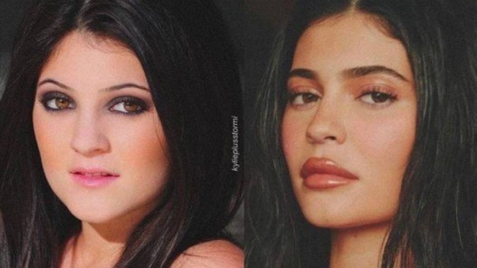 Kylie Jenner estetik iddialarını yalanlayıp "Doğalım" dedi. Ne düşünüyorsun?