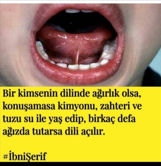 İki kelimeyi bir araya getiremiyorum ne yapmalıyım?