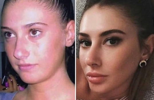 Estetikle bambaşka olan ünlülerden hangisini örnek verirdiniz?