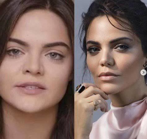Estetikle bambaşka olan ünlülerden hangisini örnek verirdiniz?