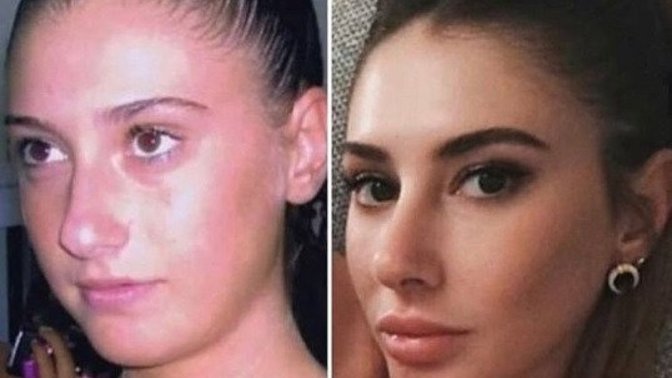 Estetikle bambaşka olan ünlülerden hangisini örnek verirdiniz?