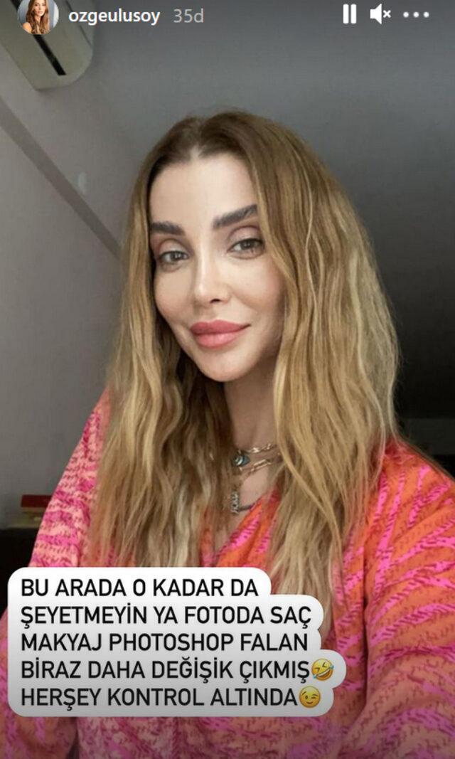 Özge Ulusoy son haliyle şaşırttı. Kontrol altında dedi! Sence nasıl olmuş?