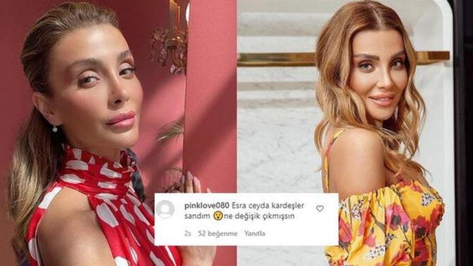 Özge Ulusoy son haliyle şaşırttı. Kontrol altında dedi! Sence nasıl olmuş?