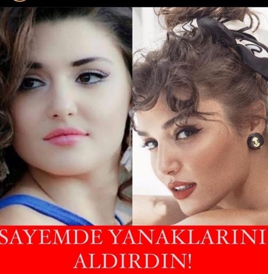 Hande erçele bazlama surat dedi tazminat ödedi sayemde güzellleşti dedi sayesindemi güzelleşti sizce?