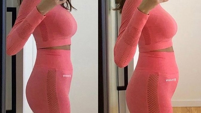 Gün içerisinde karnımın fotoğraftaki gibi şişmesi normal mi?