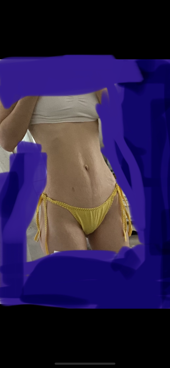 Kızlar, bu çatlaklarla bikini giyilir mi?
