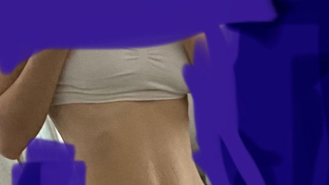 Kızlar, bu çatlaklarla bikini giyilir mi?