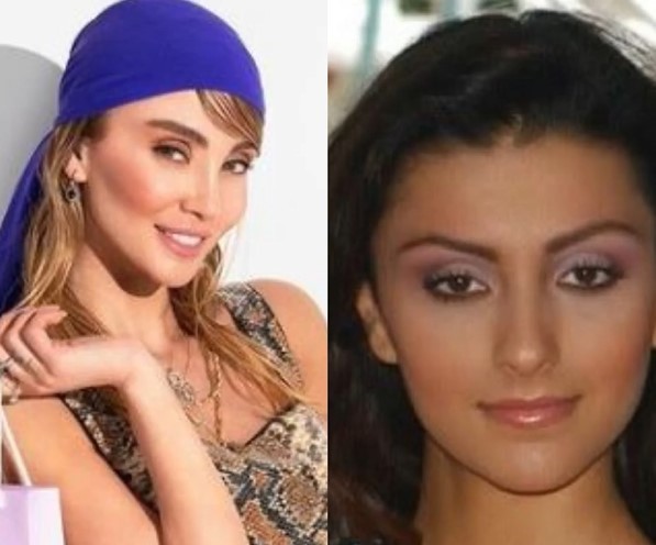 Annesinin bile tanıyamayacağı kadar değişen Özge Ulusoy Burnum dışında estetiğim yok diyor. Sen ne diyorsun?