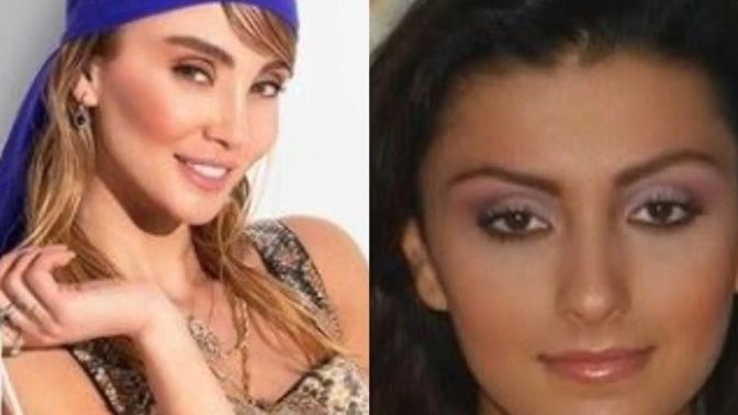 Annesinin bile tanıyamayacağı kadar değişen Özge Ulusoy "Burnum dışında estetiğim yok" diyor. Sen ne diyorsun?