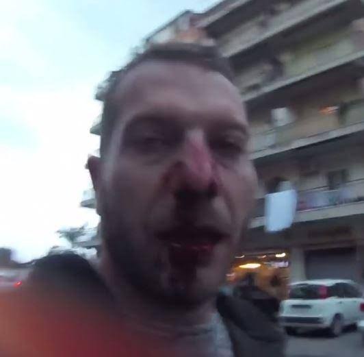 Burnuma kafa yedim?