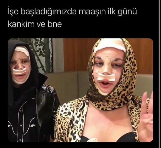 Estetik yaptırmak istediğiniz yeriniz neresi?