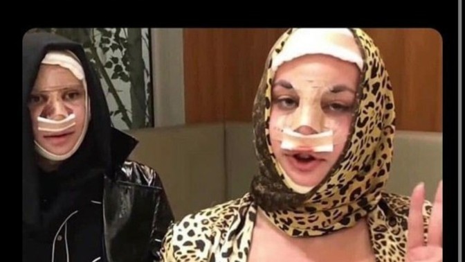 Estetik yaptırmak istediğiniz yeriniz neresi? 