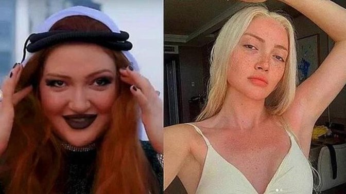 Danla Biliç estetik yaptırmadan öncede güzel miydi?