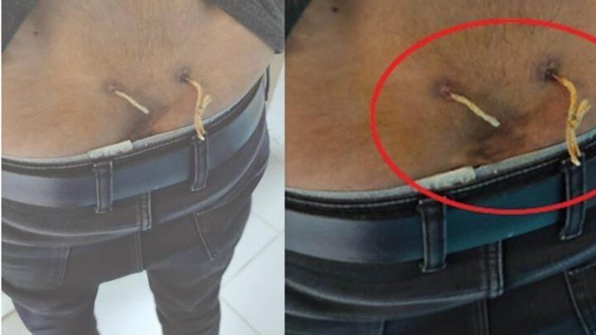 Alternatif tıp diyerek gitti, sağlığından oldu! Sen hastaneyi mi, eski usul yöntemleri mi tercih ediyorsun?