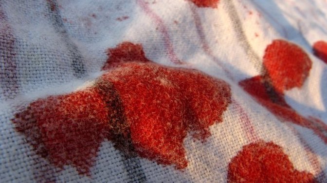 Kurumuş kan lekesini çıkarmanın en kolay yolu nedir?