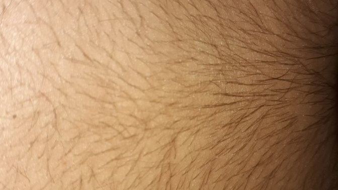 Ben bir kızım vucudum asıri tuylu ne yapmalıyım ve hormon bozuklugu icin hangi doktora gitmeliyim?