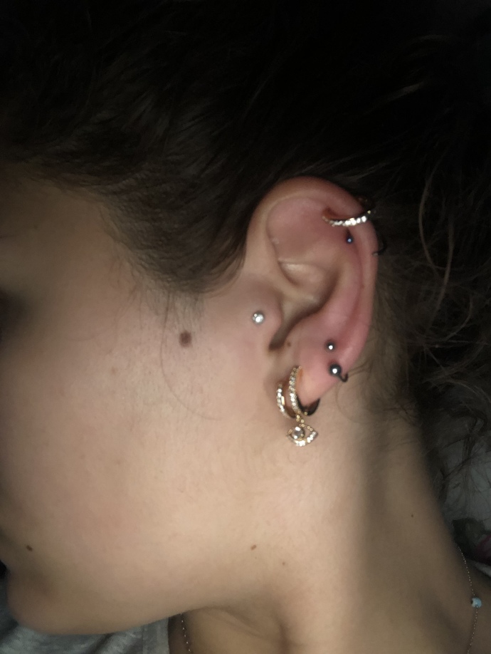 Merhaba arkadaşlar 2 gün önce kulağımı delirdim bir tragus bir alt kıkırdak birde 3. Sıradaki etli kısım durum şu sıcaklık var kulağımda dokununca acıyo bir tık şişti iki kulak arasındaki farka göre siz bişey diyin