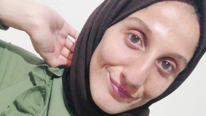 Dogal halinizi beğeniyor musunuz?