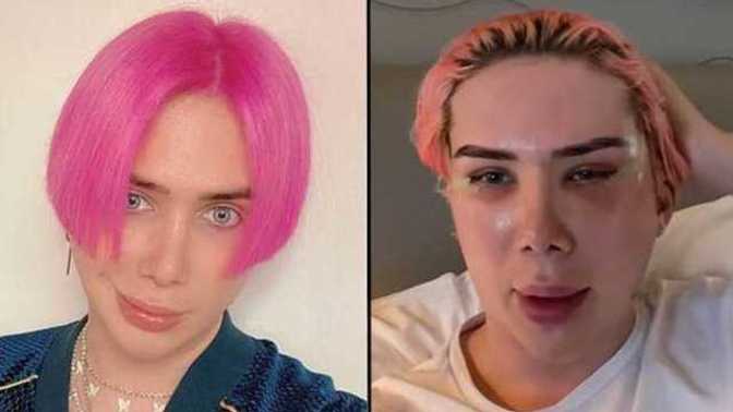 Oli London, ırk değiştirme operasyonu ile Koreli oldu! Siz bu operasyonla hangi ırk olmak isterdiniz 😅?