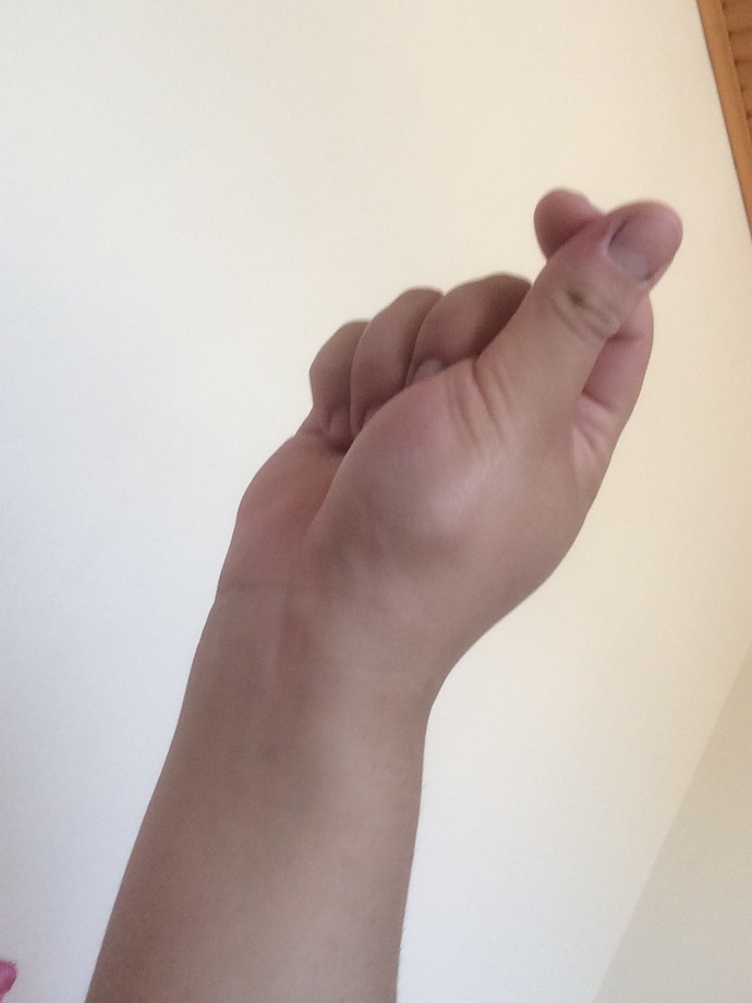 Elimi vurdum yanlışlıkla şişmiş mi sizce?