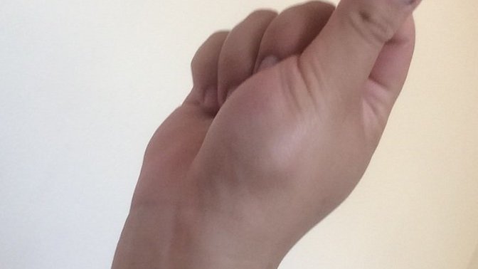 Elimi vurdum yanlışlıkla şişmiş mi sizce?