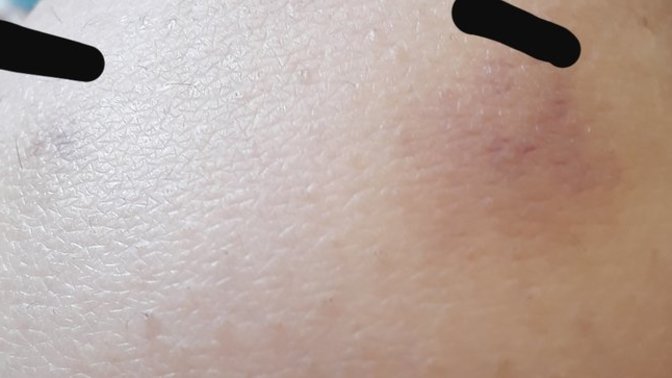 Durduk yere morarma olması?