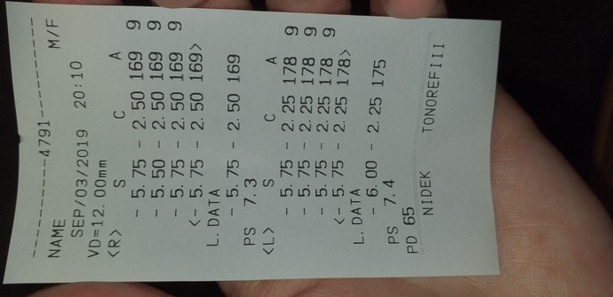 Göz ölçümünde astigmat hipermetrop  ya da  miyop çıkar mı?