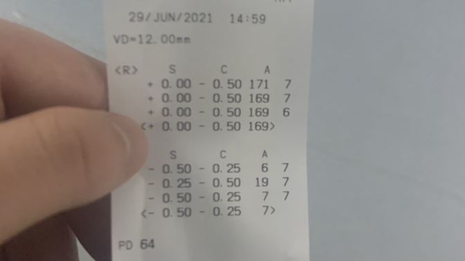 Göz ölçümünde astigmat hipermetrop  ya da  miyop çıkar mı?