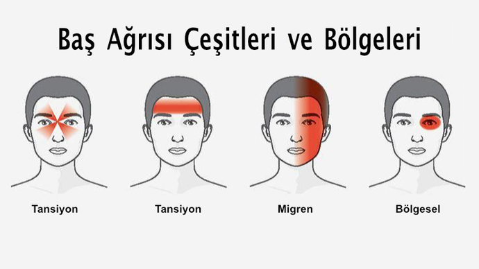 Başım çok sık ağrıyor?