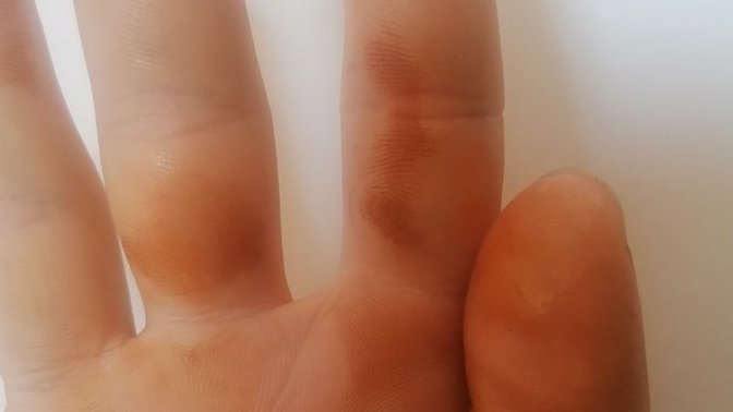 Sabah uyandım ellerimin ikiside böyle kınalanmış gibiydi yıkadım çıkmadı sizede oldumu bu?