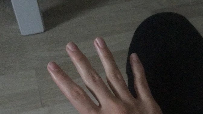 El üstündeki damarlar nasıl geçer?