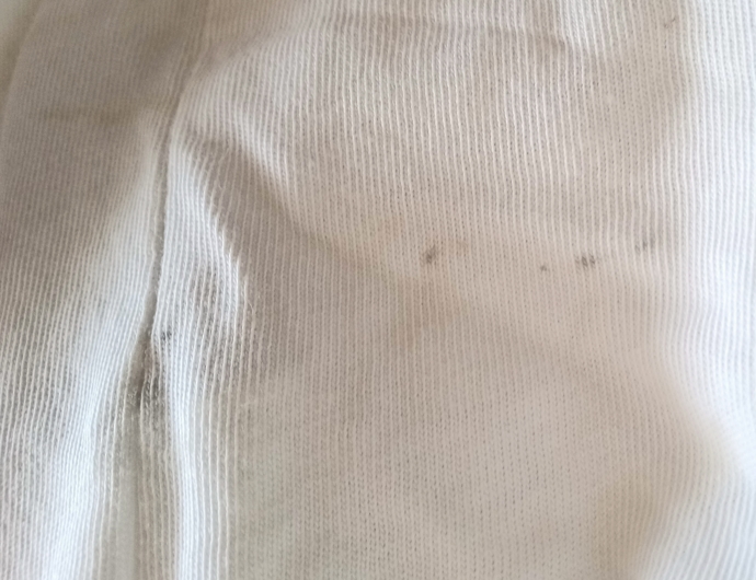 Kızlar kıyafetimdeki lekeler nasıl çıkar?
